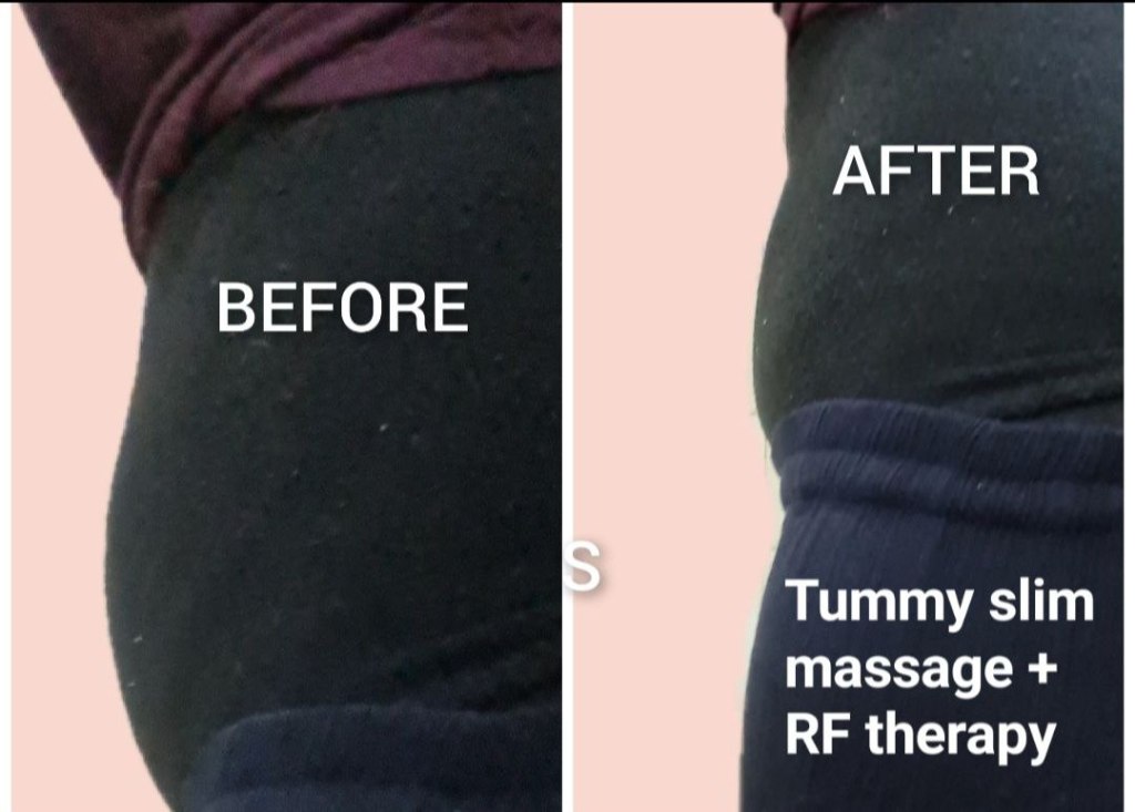 muslimah massage slim fat burns Singapore